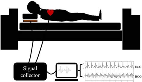 Heart Rate Detection Method Based On Ballistocardiogram Signal Of