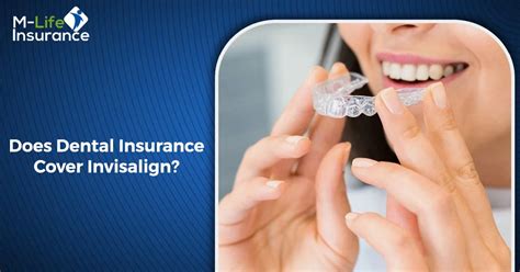 
h1 Dental Insurance That Covers Invisalign