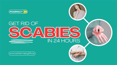 **Get Rid of Scabies in 24 Hours: Powerfully Effective Methods You Must Try**