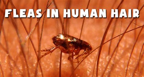 **How Can Dog Fleas Get Into Human Hair?**