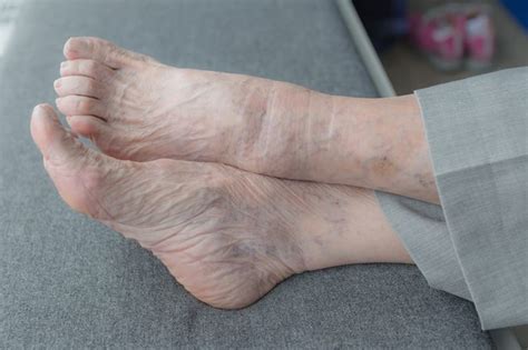 **Mature Women Feet: A Comprehensive Guide to Care and Style**