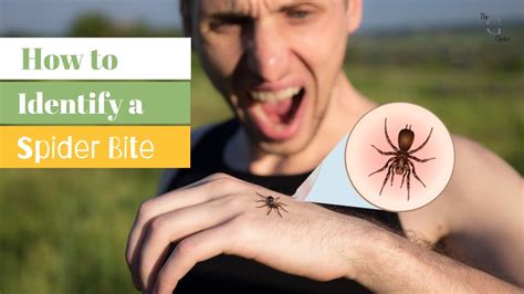 **Spider Bite Identification: The Art of Recognizing Your Eight-Legged Guest**