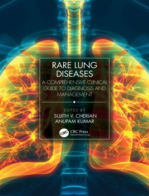 **StarRb29: A Comprehensive Guide to the Rare Disease and Its Management**