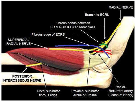 *Nerve compression: