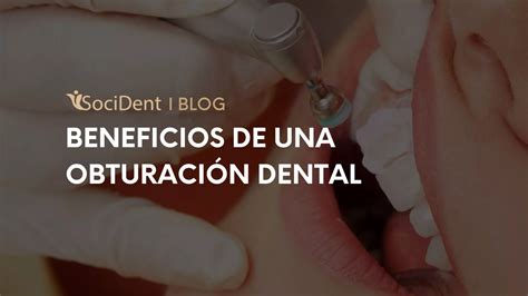 ¡Adiós Caries! Beneficios de la Obturación Dental en Español (Relleno de Cavidades en Español)