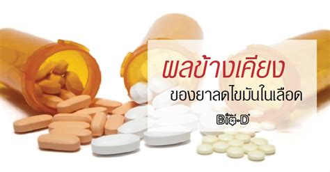 อีซีติมิบ (Ezetimibe): ยาลดคอเลสเตอรอลที่ไม่ใช่สเตติน