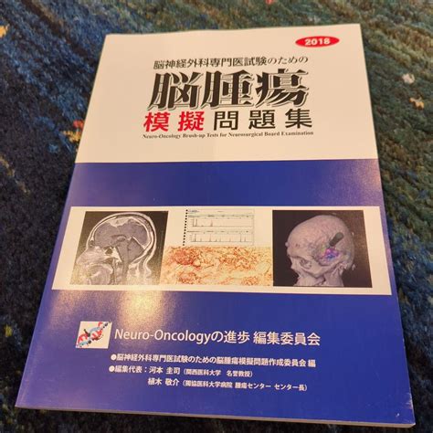 いっちゃんの脳腫瘍と向き合うための包括的なガイド