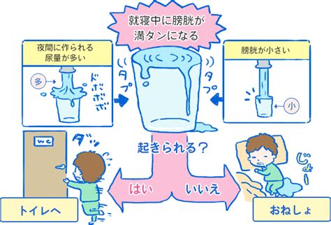 おねしょの予防と対策：お風呂でできること