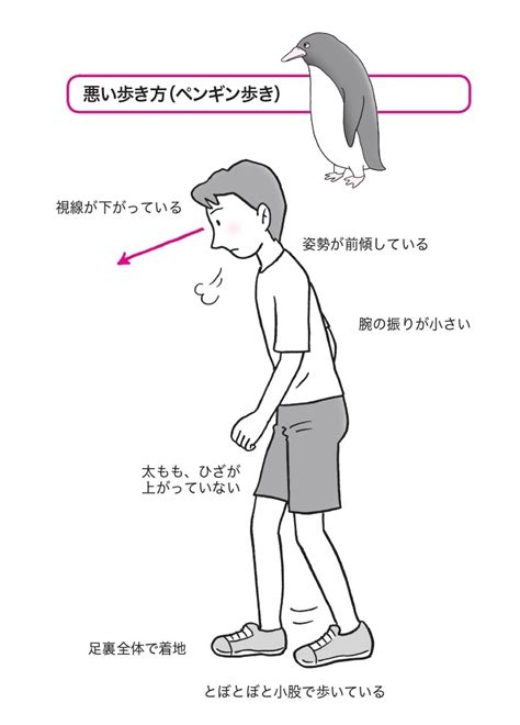 ちょこちょこ歩く病気とは？