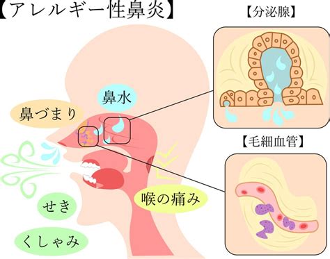 アレルギー性鼻炎サプリが及ぼす効果