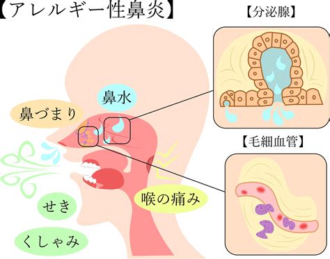 アレルギー性鼻炎サプリでつらい症状を和らげる