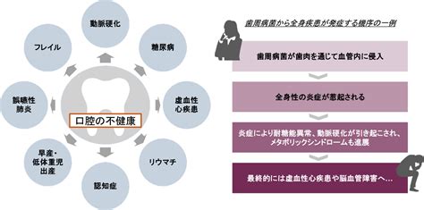 オーラルケアのすべて: 健康的な口腔内のために