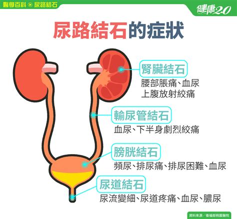 クランベリー 尿 路 結石