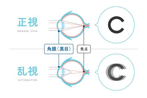 コンタクトの意味を徹底解説