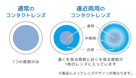 コンタクトレンズとは何か？種類、メリット、デメリット