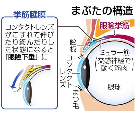 コンタクトレンズ使用時の瞬き増加と目の健康