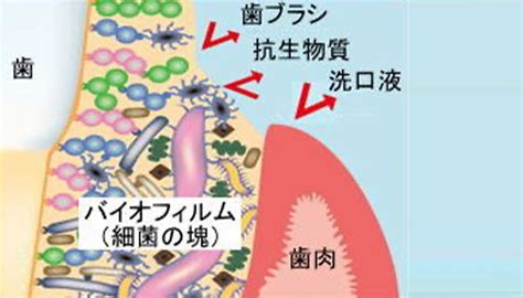 デンタルバイオの口コミ・評判を徹底検証！メリットデメリットから注意点までを詳しく解説