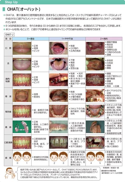 デンタル バイツ: 健康的な口腔衛生のための包括的なガイド