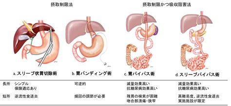 ドクターズダイエット公式: 安全かつ効果的に減量するための包括的ガイド