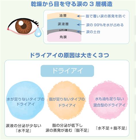 ドライアイの原因と症状