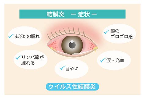 ネバネバした目やにの原因と対策