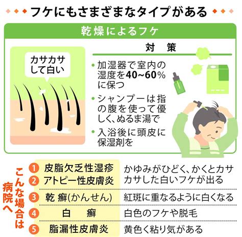 フケが出る冬にこそ知っておきたい！原因と対策のすべて