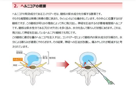 ヘルニア クロール: 対処法、予防法、最新治療法