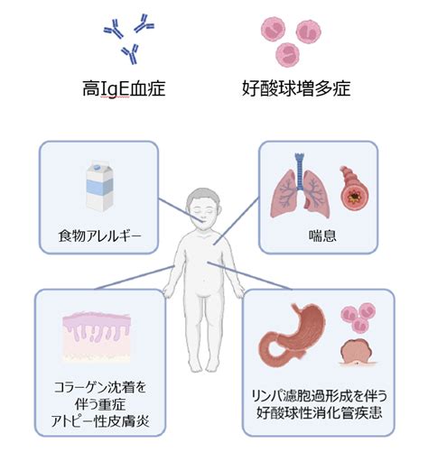 主な遺伝的疾患: