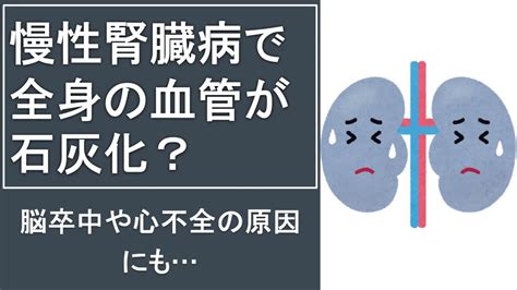 副腎石灰化のすべて：原因、症状、診断、治療