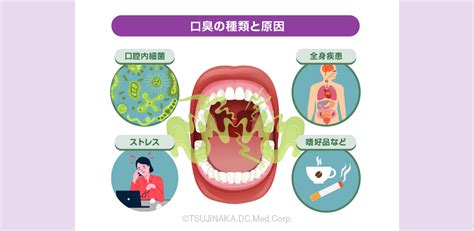 口臭とは？