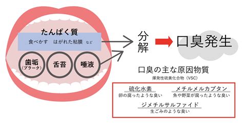 口臭の原因と対策：お菓子が招く口臭を防ぐ