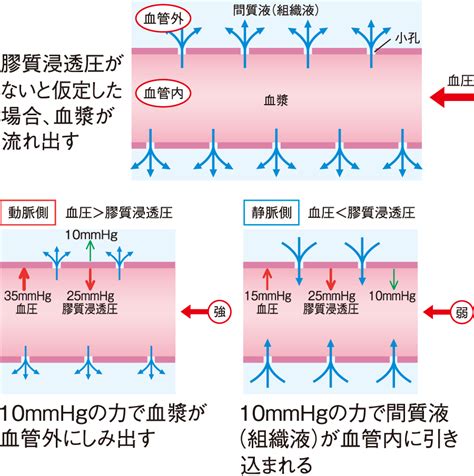 圧迫による血流障害：