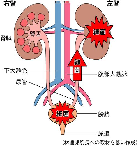 尿路感染症の予防と治療