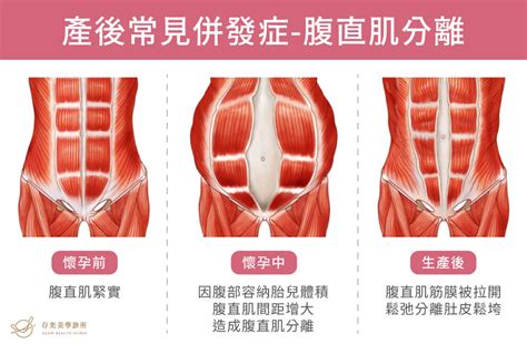 常見的肚子問題