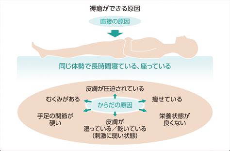 床ずれ予防で、あなたやあなたの大切な人を守ろう