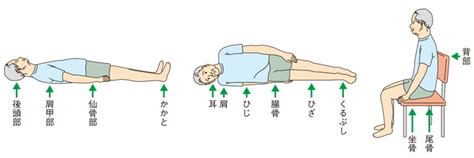 床ずれ予防：大切な人への快適な生活を守るための包括ガイド