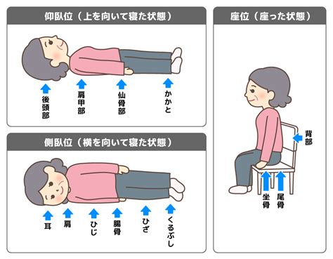 床ずれ対策を徹底解説！予防・治療法から最新技術まで