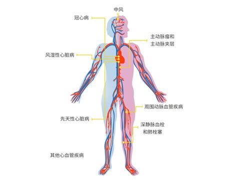 心血管疾病：