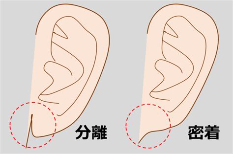 折れ耳遺伝子（Fd遺伝子）