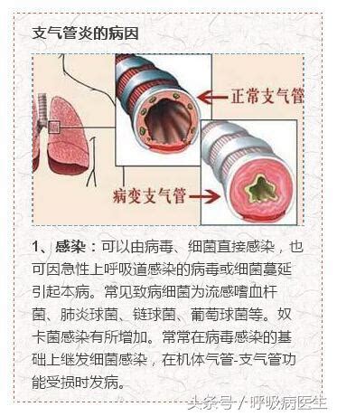 支氣管炎：