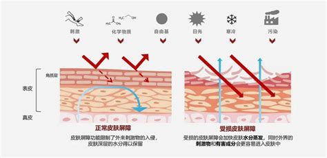 敏感肌膚的成因