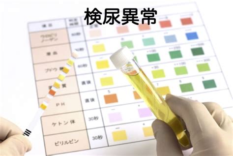 検尿はいつ取るべき？健康診断や病気の早期発見のために