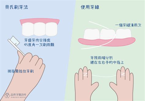 步驟1：專業潔牙