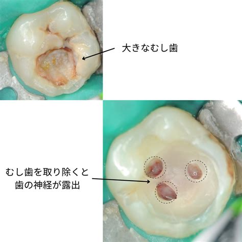 歯の状態：