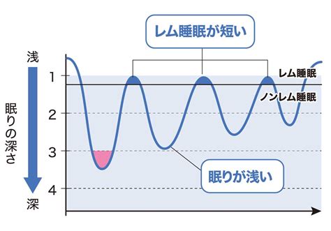 浅い睡眠の増加：