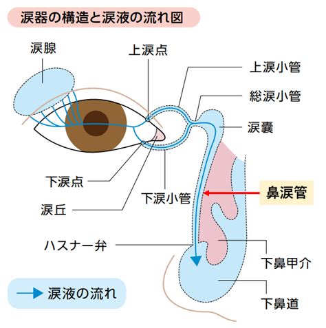 涙管の狭窄または閉塞：