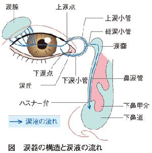 涙管閉塞: