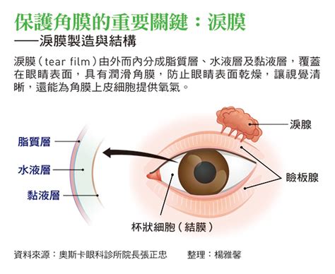 淚線的定義與結構