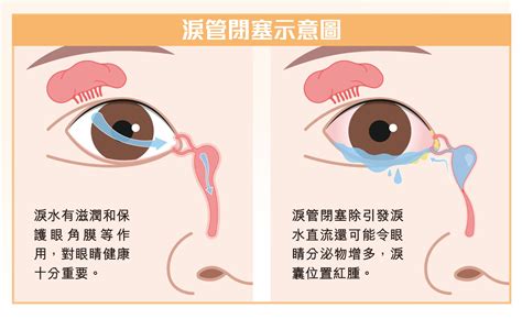 淚腺：情感的流露管道