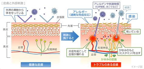 炎症と皮膚の刺激：